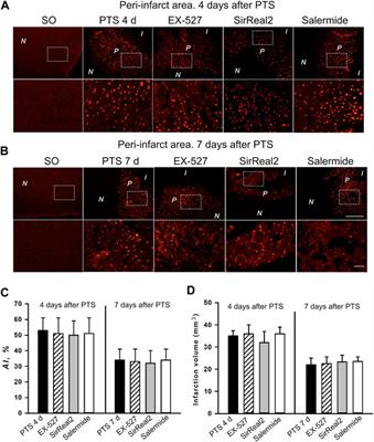 Sirtuins 1 and 2 in the Acute Period After Photothrombotic Stroke: Expression, Localization and Involvement in Apoptosis